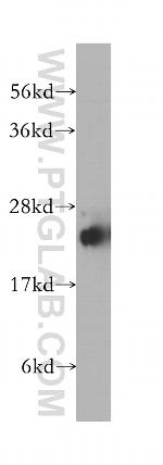 STMN4 Antibody in Western Blot (WB)