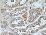 WBP2 Antibody in Immunohistochemistry (Paraffin) (IHC (P))