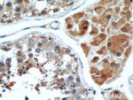 WBP2 Antibody in Immunohistochemistry (Paraffin) (IHC (P))