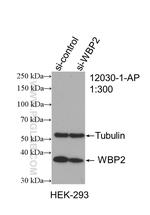 WBP2 Antibody in Western Blot (WB)