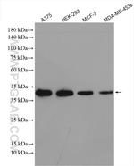 WBP2 Antibody in Western Blot (WB)