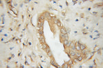 STT3A Antibody in Immunohistochemistry (Paraffin) (IHC (P))