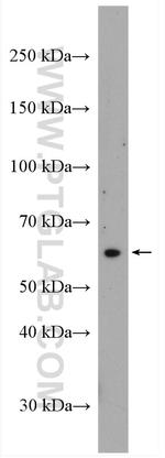 STT3A Antibody in Western Blot (WB)
