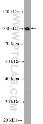 STT3A Antibody in Western Blot (WB)