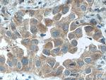 DVL2 Antibody in Immunohistochemistry (Paraffin) (IHC (P))