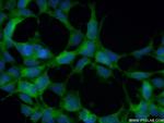 HURP Antibody in Immunocytochemistry (ICC/IF)