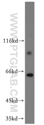 HURP Antibody in Western Blot (WB)