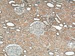 DISP1 Antibody in Immunohistochemistry (Paraffin) (IHC (P))