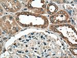 DISP1 Antibody in Immunohistochemistry (Paraffin) (IHC (P))