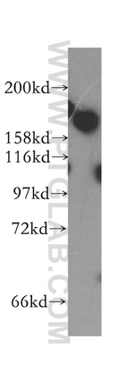 DISP1 Antibody in Western Blot (WB)