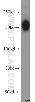 DISP1 Antibody in Western Blot (WB)