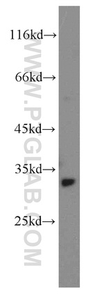 STOM Antibody in Western Blot (WB)