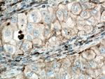 STOM Antibody in Immunohistochemistry (Paraffin) (IHC (P))