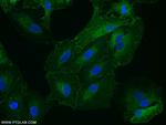 STOM Antibody in Immunocytochemistry (ICC/IF)