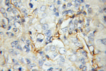 STOM Antibody in Immunohistochemistry (Paraffin) (IHC (P))