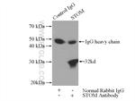 STOM Antibody in Immunoprecipitation (IP)