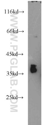 CRX Antibody in Western Blot (WB)