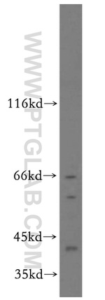 SLU7 Antibody in Western Blot (WB)