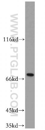 SLU7 Antibody in Western Blot (WB)