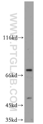 SLU7 Antibody in Western Blot (WB)