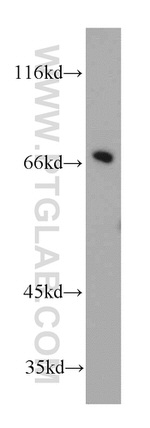 SLU7 Antibody in Western Blot (WB)