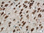 PELI1 Antibody in Immunohistochemistry (Paraffin) (IHC (P))