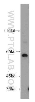 PSMD3 Antibody in Western Blot (WB)