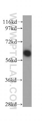 PSMD3 Antibody in Western Blot (WB)