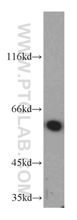 PSMD3 Antibody in Western Blot (WB)