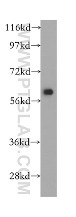 PSMD3 Antibody in Western Blot (WB)