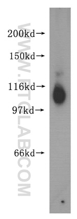 RTN3 Antibody in Western Blot (WB)