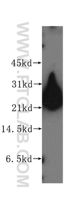 RTN3 Antibody in Western Blot (WB)