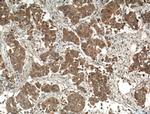 ODF2 Antibody in Immunohistochemistry (Paraffin) (IHC (P))