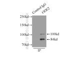 ODF2 Antibody in Immunoprecipitation (IP)