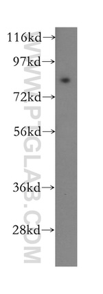 ODF2 Antibody in Western Blot (WB)