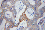 PSMD14/POH1 Antibody in Immunohistochemistry (Paraffin) (IHC (P))