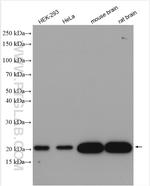 KRAS Antibody in Western Blot (WB)