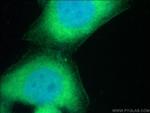 KRAS Antibody in Immunocytochemistry (ICC/IF)