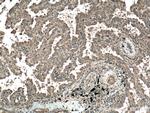 KRAS Antibody in Immunohistochemistry (Paraffin) (IHC (P))