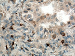 KRAS Antibody in Immunohistochemistry (Paraffin) (IHC (P))