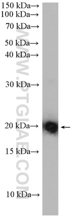 KRAS Antibody in Western Blot (WB)