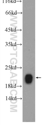 KRAS Antibody in Western Blot (WB)