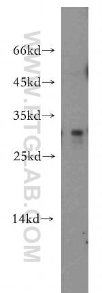 IL-24 Antibody in Western Blot (WB)