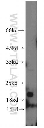 NBL1 Antibody in Western Blot (WB)