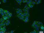 STAT5B Antibody in Immunocytochemistry (ICC/IF)