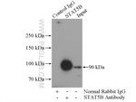 STAT5B Antibody in Immunoprecipitation (IP)