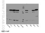 STAT5B Antibody in Western Blot (WB)