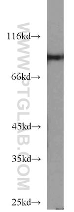 STAT5B Antibody in Western Blot (WB)