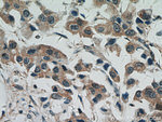 STAT5B Antibody in Immunohistochemistry (Paraffin) (IHC (P))