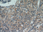 STAT5B Antibody in Immunohistochemistry (Paraffin) (IHC (P))